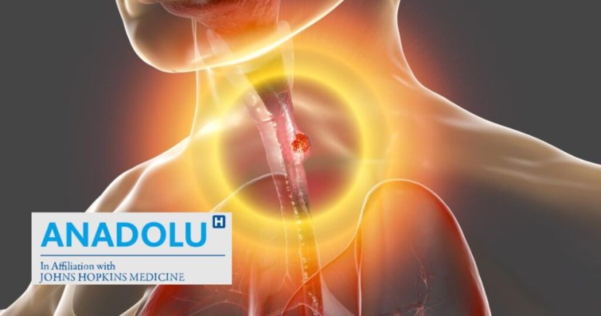 CANCER DE L’ŒSOPHAGE : Symptômes et Traitement (Centre Médical Anadolu)