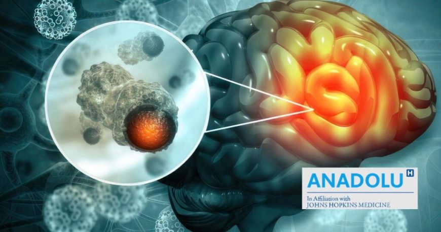 Face au cancer du cerveau : Les armes de la médecine pour vaincre la maladie